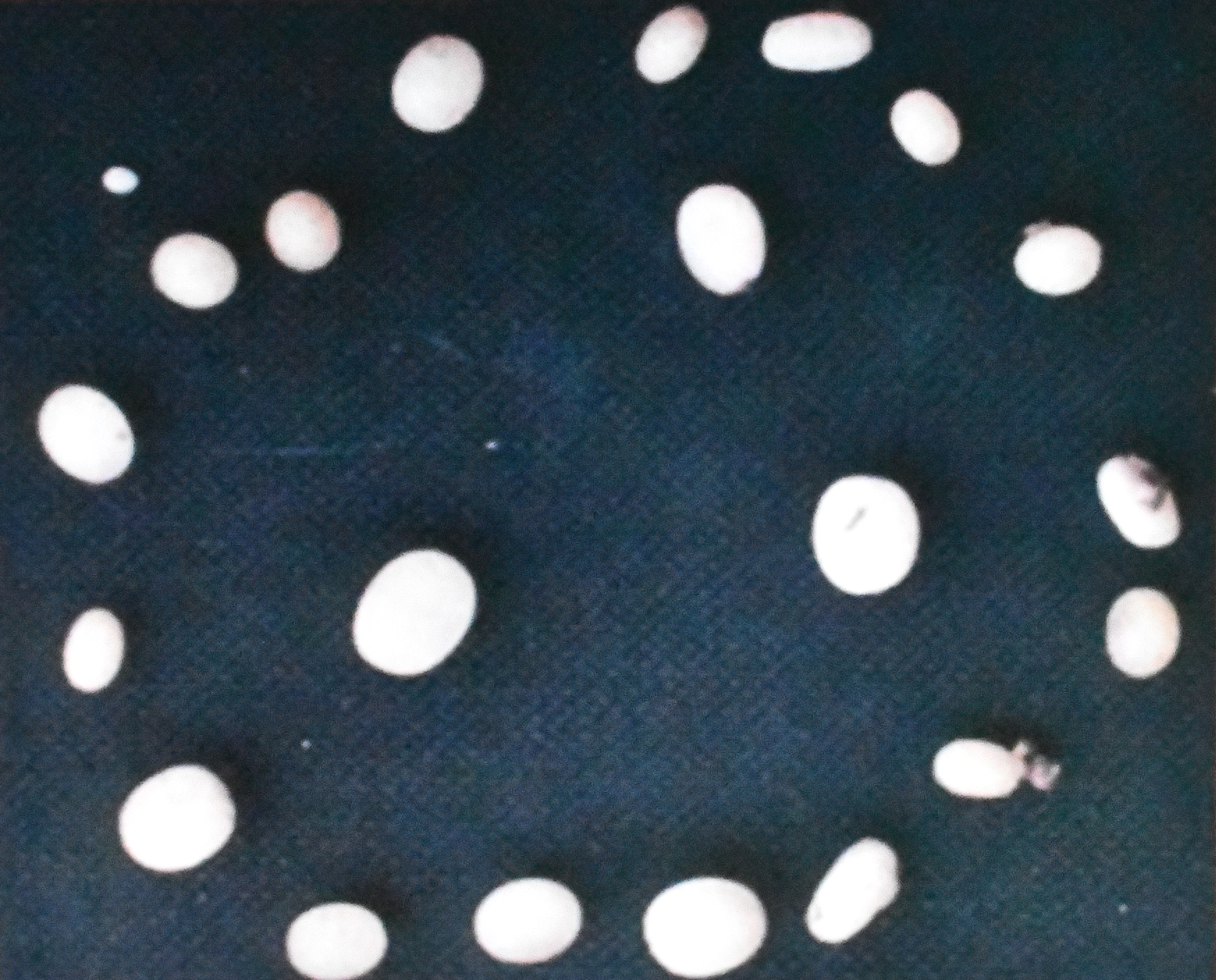 White grub eggs